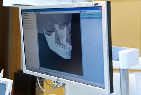 Dr. Péter Lukács - Arcus Digma II Kreativ Dental Clinic