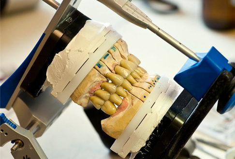 Articulator, ARCUSdigma II - Kreativ Dental Clinic