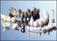 Dental Treatment Broad