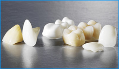Full Porcelain (metal free) Crowns Abroad