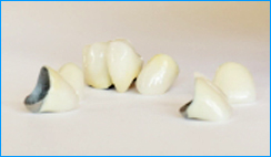 Porcelain Crowns Abroad
