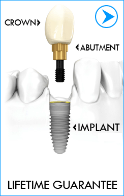 Dental Treatment Abroad