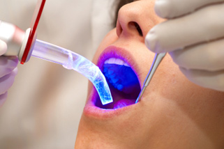 Cosmetic Dental treatment Kreativ in Budapest