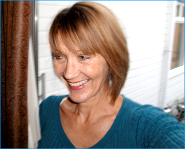 Crowns, Teeth Implants and Bridge work at Kreativ Dental Clinic recommended dentist abroad